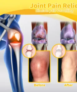 HOOMWELL™ Bee Venom Advanced Joint and Bone Healing Cream