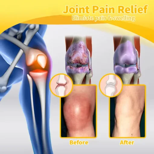 HOOMWELL™ Bee Venom Advanced Joint and Bone Healing Cream