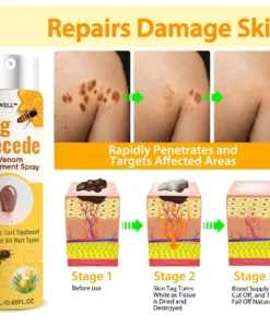 HOOMWELL™ Gentle Skin Tag & Wart Removal Spray with Tea Tree Oil