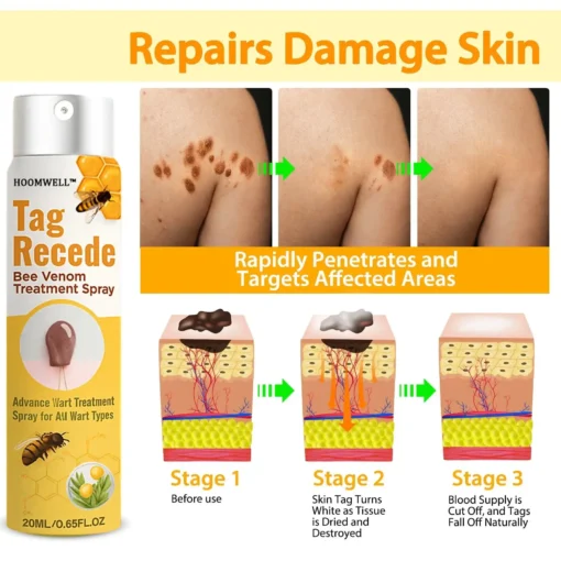 HOOMWELL™ Gentle Skin Tag & Wart Removal Spray with Tea Tree Oil