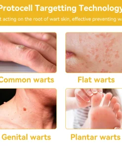 HOOMWELL™ Gentle Skin Tag & Wart Removal Spray with Tea Tree Oil