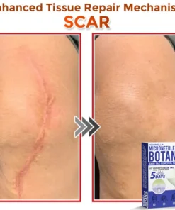 HOOMWELL™ MicroNeedle Botanic Skin Tag Removal Patch
