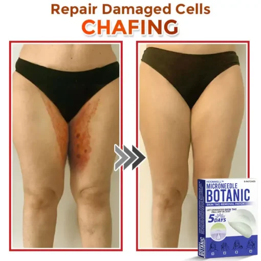 HOOMWELL™ MicroNeedle Botanic Skin Tag Removal Patch