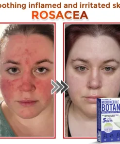 HOOMWELL™ MicroNeedle Botanic Skin Tag Removal Patch
