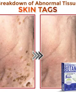 HOOMWELL™ MicroNeedle Botanic Skin Tag Removal Patch