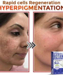 HOOMWELL™ MicroNeedle Botanic Skin Tag Removal Patch