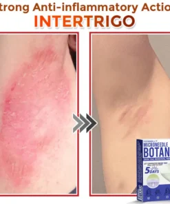 HOOMWELL™ MicroNeedle Botanic Skin Tag Removal Patch