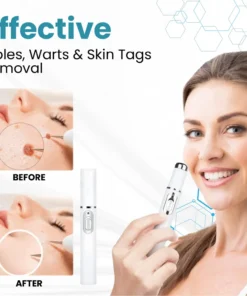 HOOMWELL™ Non-Invasive Mole and Wart Removal Laser Pen