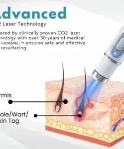 HOOMWELL™ Non-Invasive Mole and Wart Removal Laser Pen