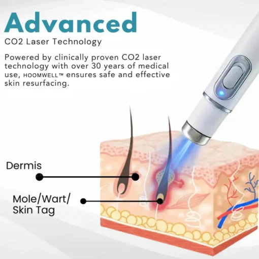 HOOMWELL™ Non-Invasive Mole and Wart Removal Laser Pen