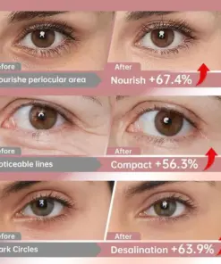 HOOMWELL™ Deep Collagen Eye Patches Lift, Brighten Instantly Depuff for Glass-Glow Eyes 70 OFF Today Only