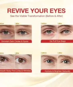 HOOMWELL™ Deep Collagen Eye Patches Lift, Brighten Instantly Depuff for Glass-Glow Eyes 70 OFF Today Only